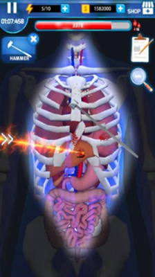 手术大师汉化最新安卓下载